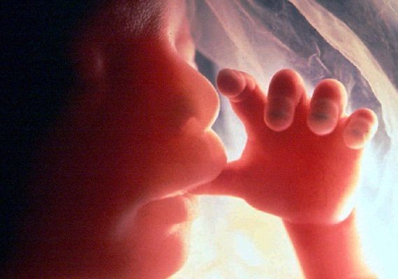 Fetal Surgeries – عمليات الأجنّة